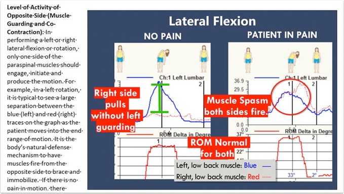 lateral-flexion